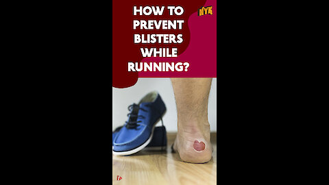 How To Prevent Blisters While Running? *