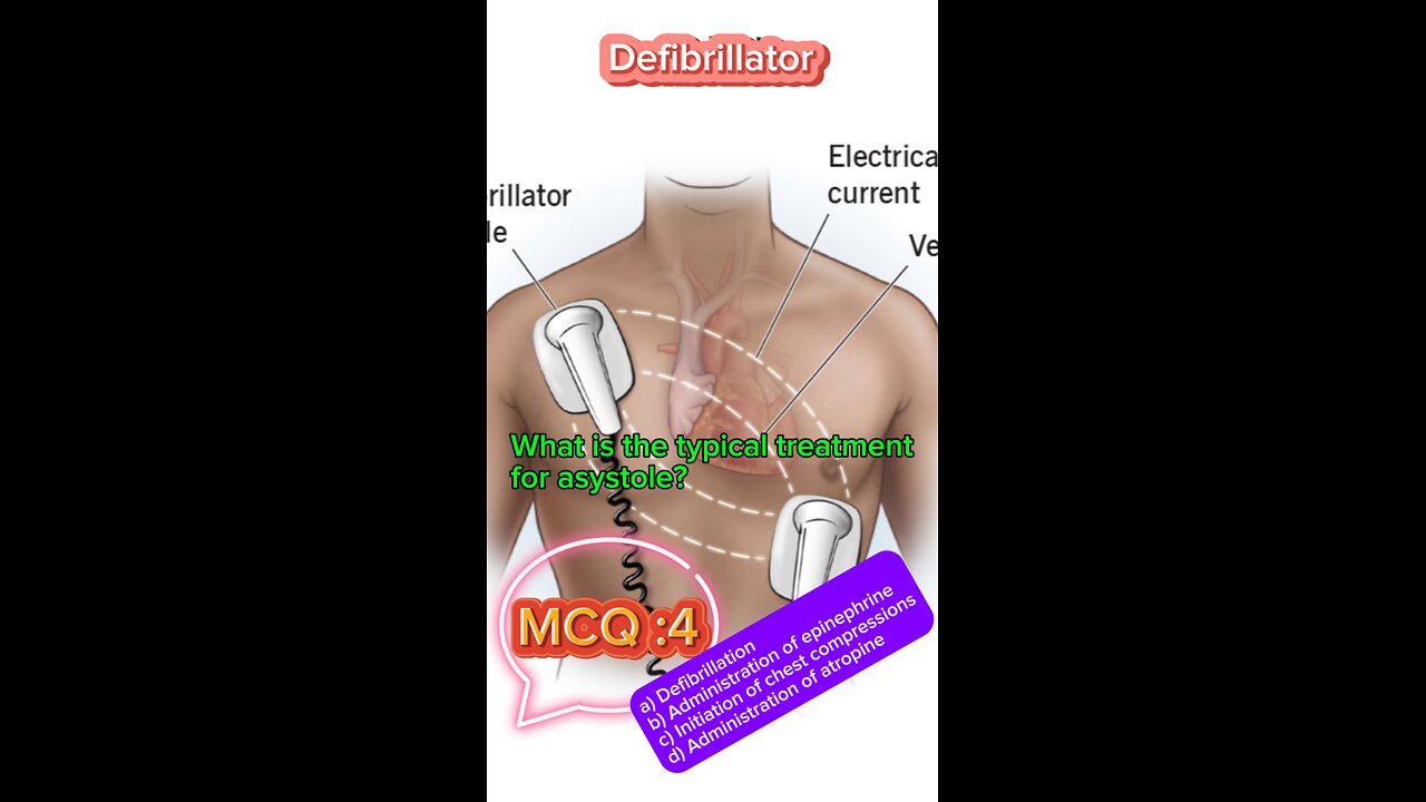 Defibrillator machine in icu #defibrillator #mcqs #pharmacologynotes #MedicalQuiz #mcqs #quiz