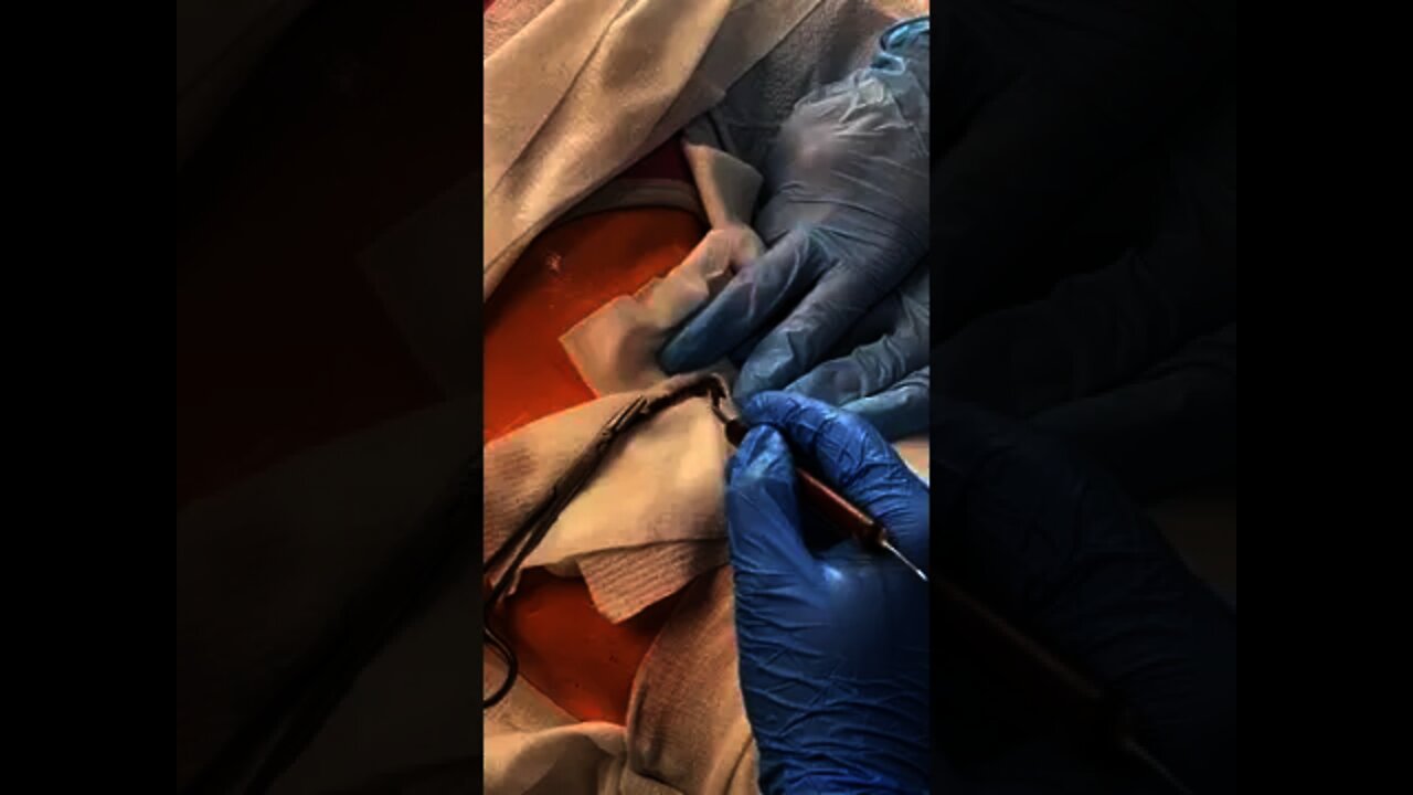 When it came out of her belly button!!