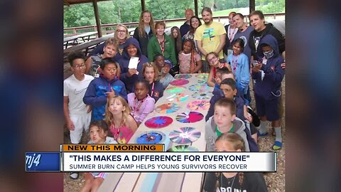 Walworth County camp for burn victims celebrates its 25th year