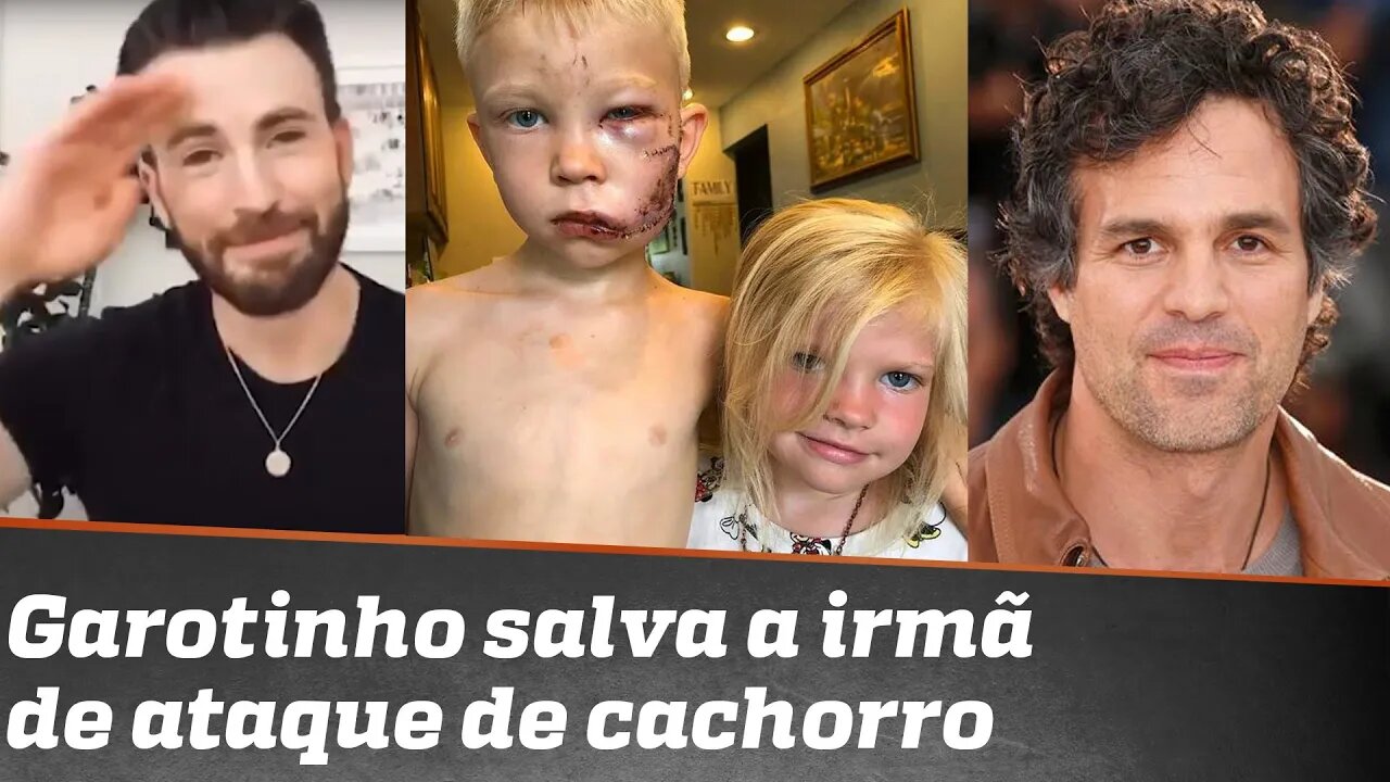 Garotinho salva a irmã de ataque de cachorro e ganha moral com Vingadores