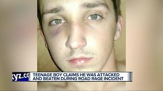 Teenage boy claims he was attacked and beaten during road rage incident