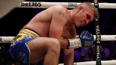 Liam Smith Praises Eubank: He Was The Better Man, I Was Flat