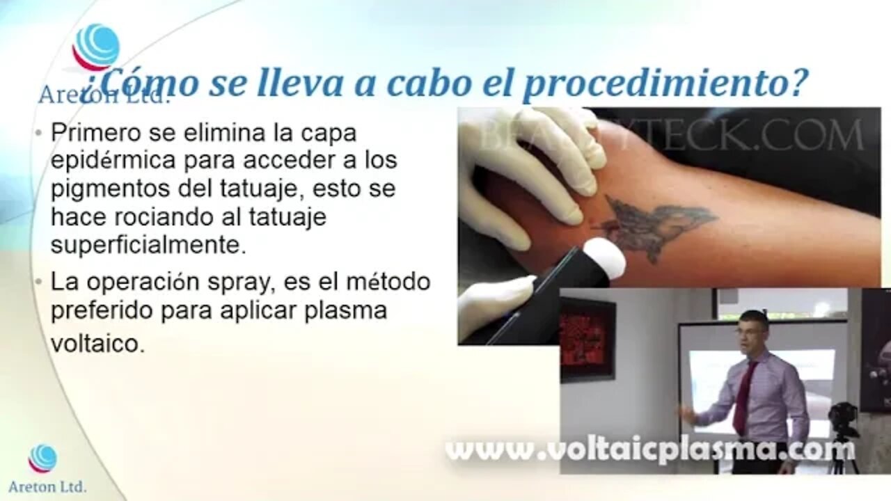 CASO ESTUDIO DE ELIMIACION DE TATUAJE