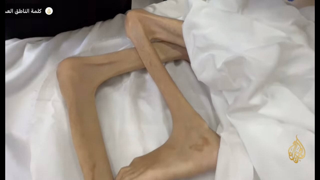 America & Its Allies Using Starvation As A Weapon Of War In Palestine #warzone
