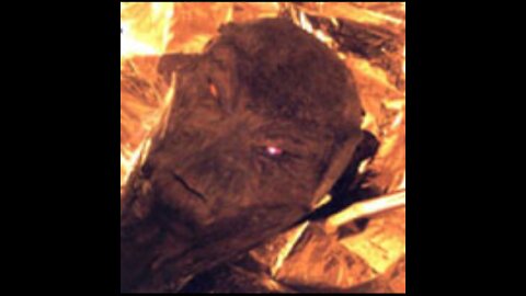 Strange ET examination