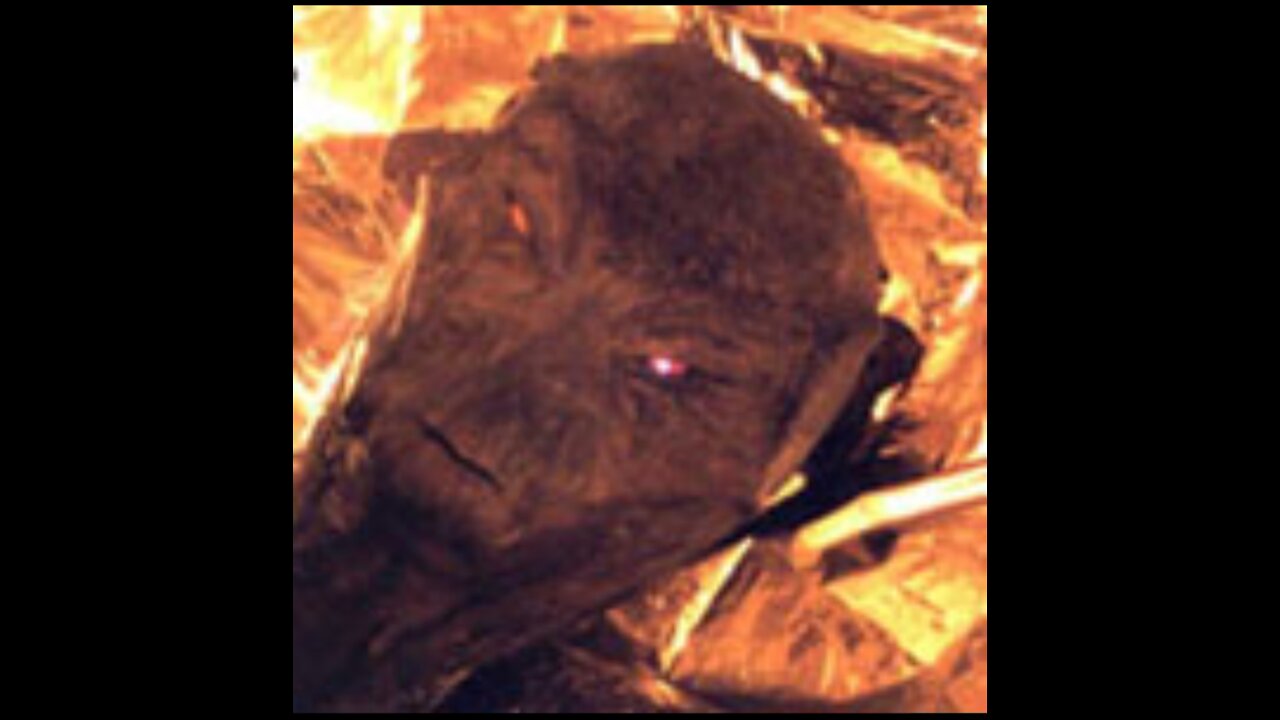 Strange ET examination