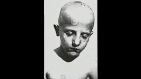 The Ringworm Children testing of large radiation doses on humans.