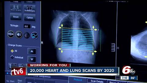 20,000 heart and lung scans at Hendricks Regional Health