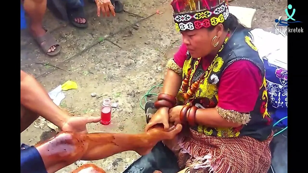 Pengobatan Ibu Ida Dayak | kakek ini stroke ditangani Ibu Ida, jalan perlahan