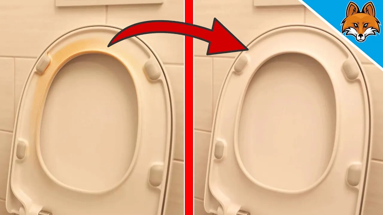 How to remove YELLOW STAINS from toilet seat ⚡️ Get toilet seat WHITE again 💥