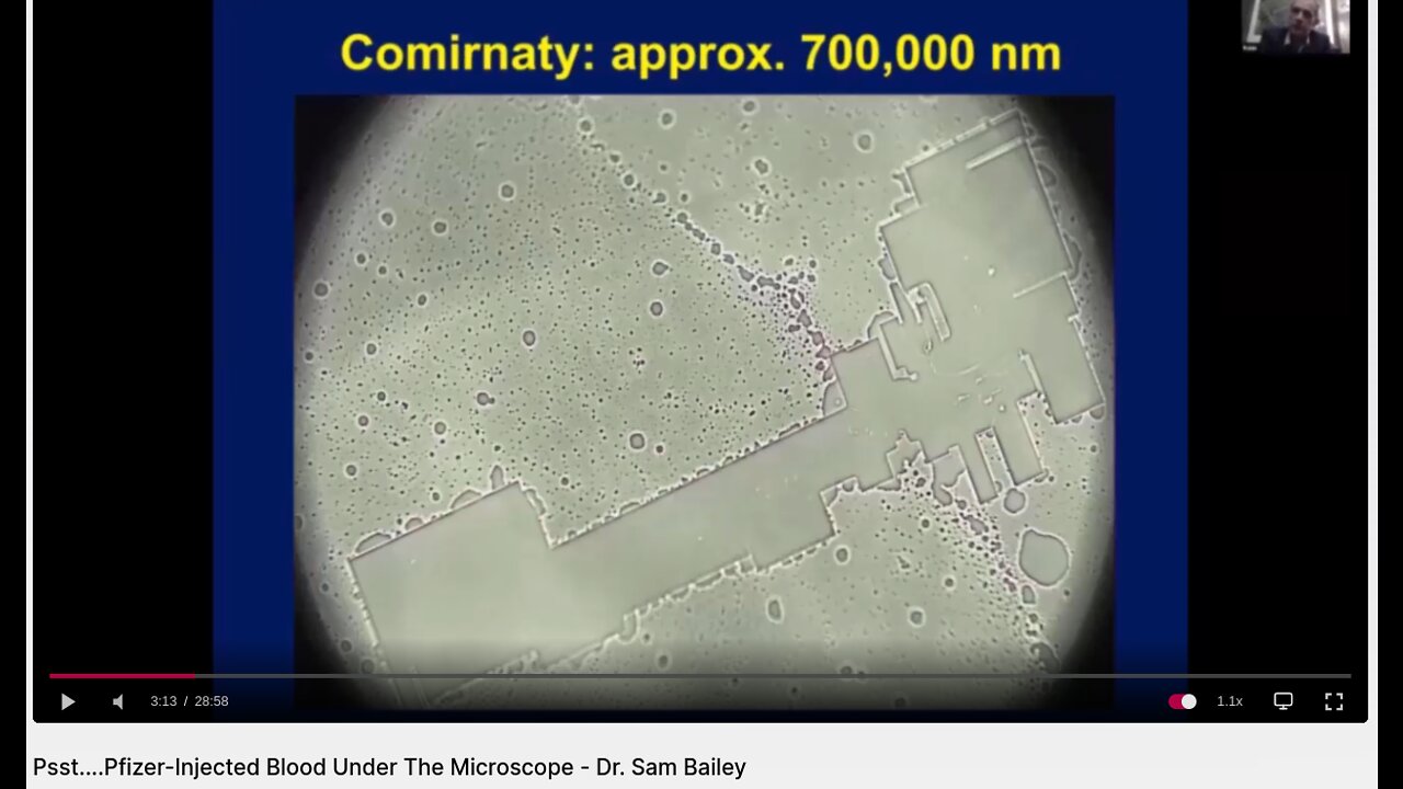 [VAX NOT GOOD] Psst....Pfizer-Injected Blood Under The Microscope - Dr. Sam Bailey