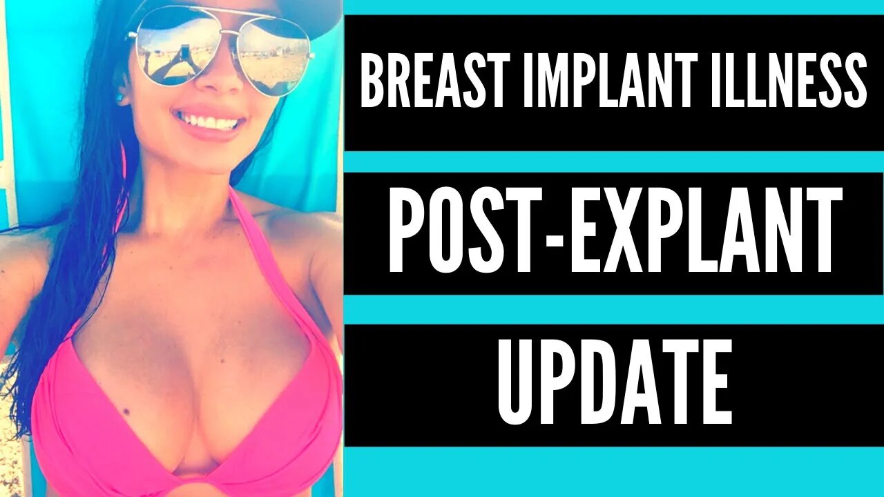 BREAST IMPLANT ILLNESS: POST EXPLANT UPDATE: HOW AM I FEELING?