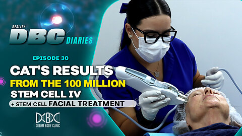 DBC Diaries Ep 30: Cat's Results from the 100 million stem cell IV + Stem Cell Facial Treatment