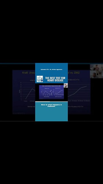 Kraft test - The best test for heart disease