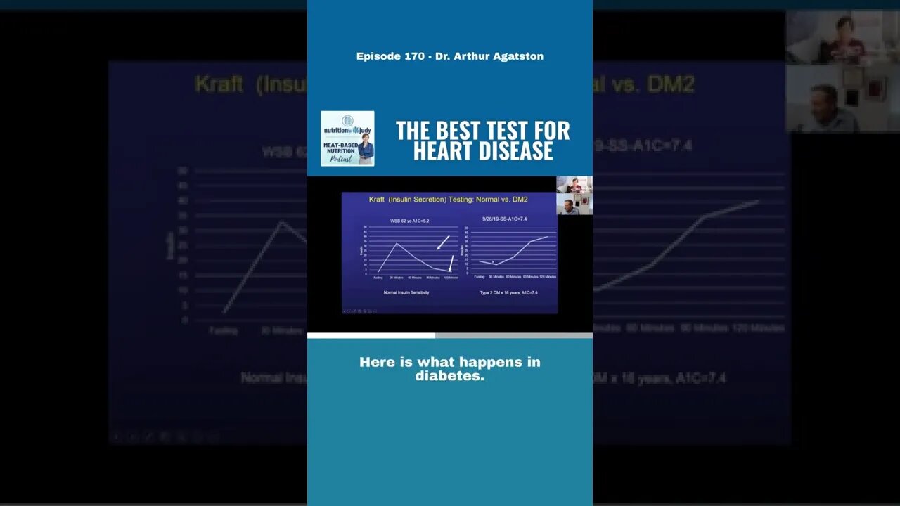 Kraft test - The best test for heart disease