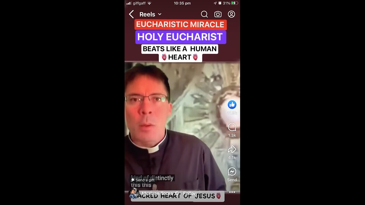 Eucharistic Miracle :beating Heart