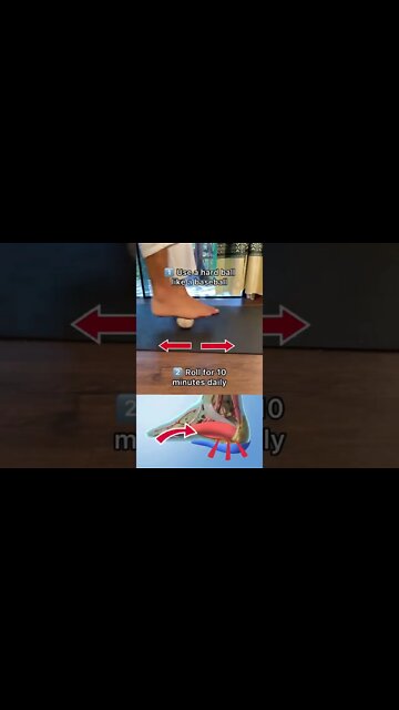 Got Heel Pain (Plantar Fasciitis Pain Relief)