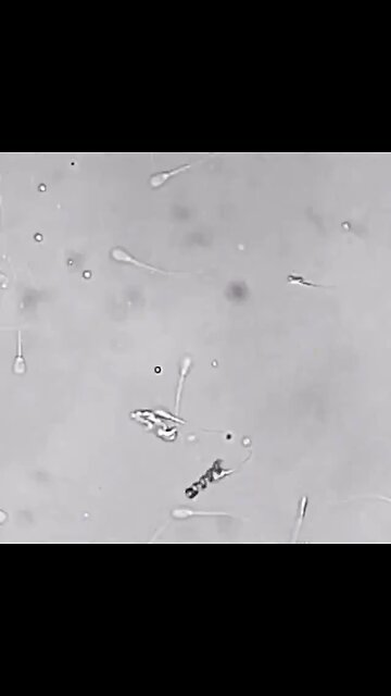 A nanobot helping a sperm with motility issues along towards an egg.