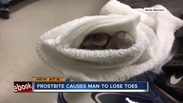 Homeless man to lose toes due to frostbite