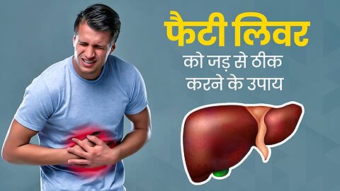 Liver Problem Best Ayurvedic Solution Effective Home Remedies For Fatty Liver फैटी लिवर कैसे ठीक करे