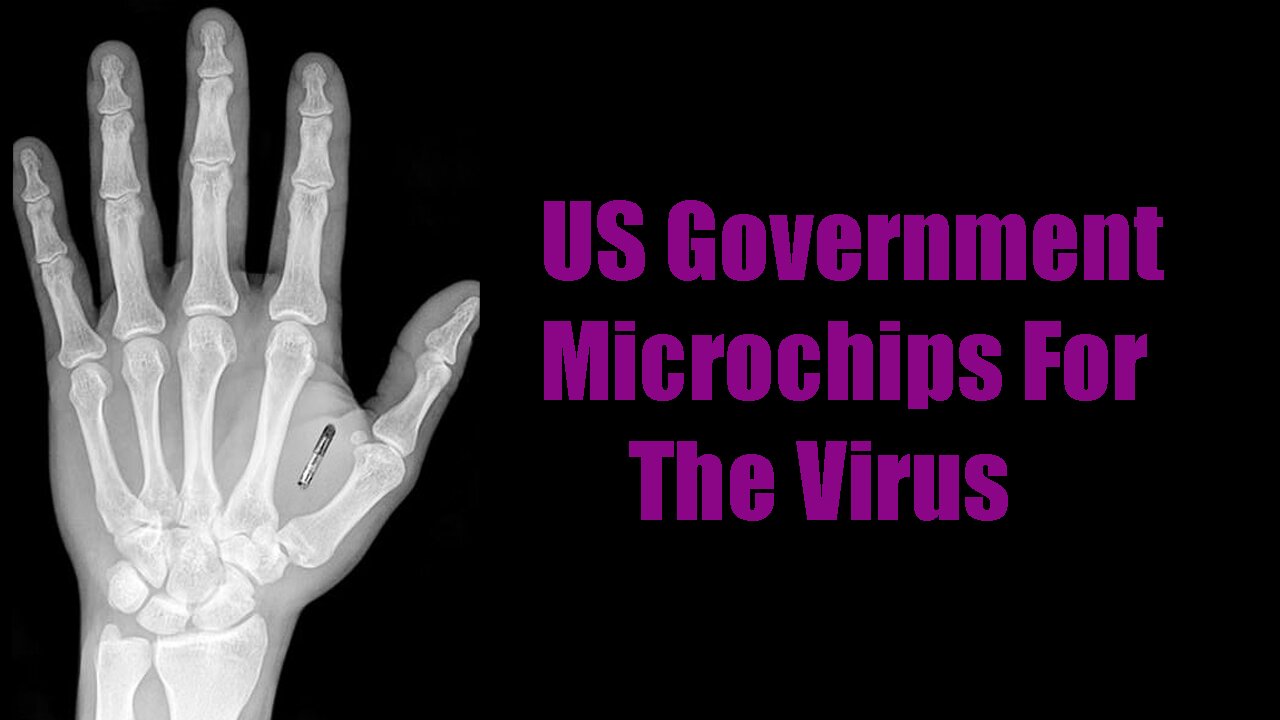 US Gov Developing Microchips For The Virus