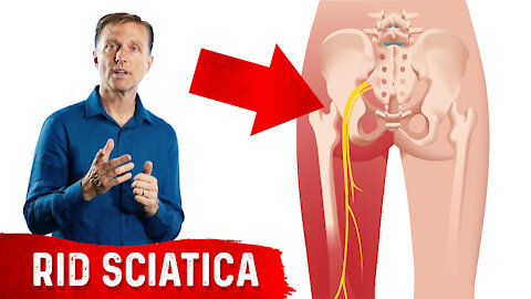 5 Herbal Remedies for Sciatica