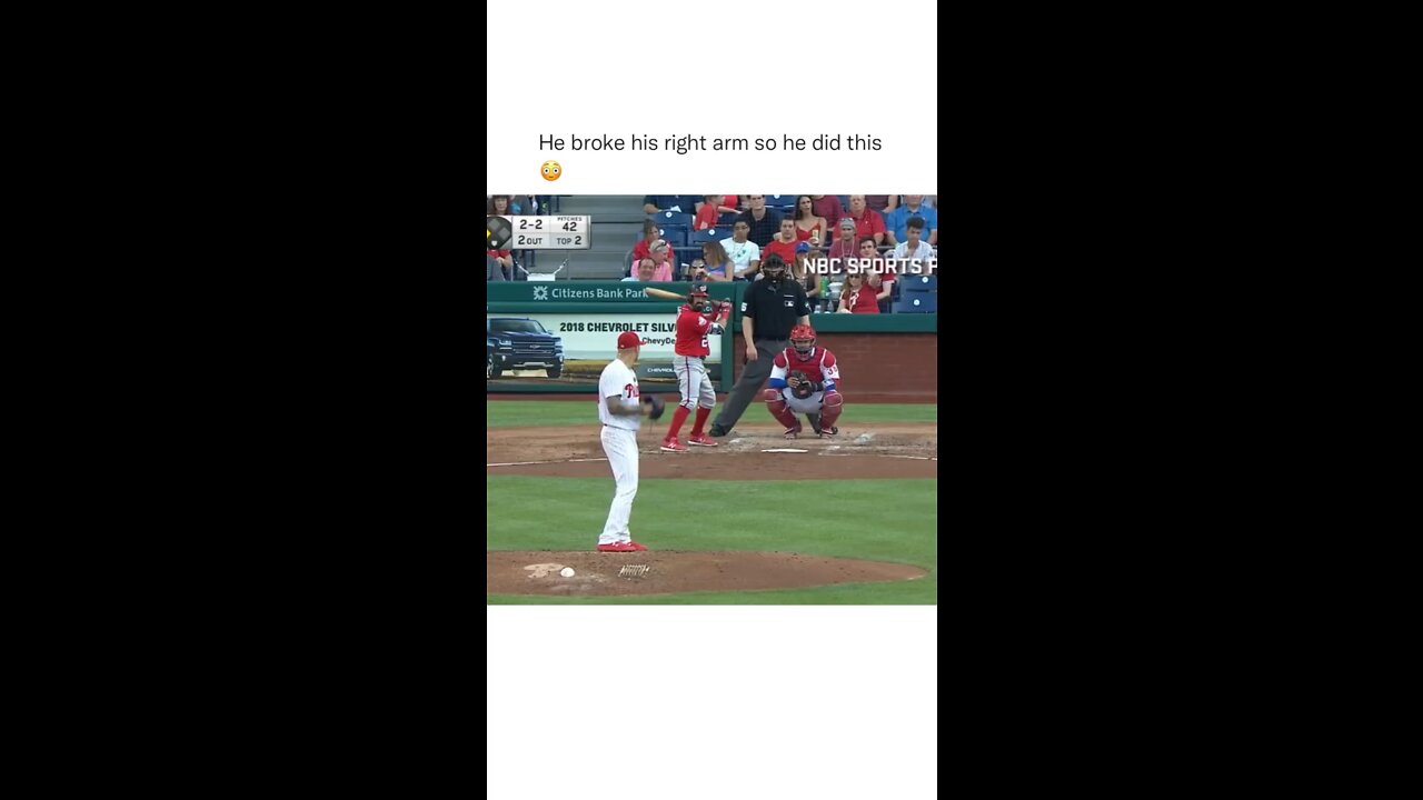 MLB player breaks arm and then did this🤯