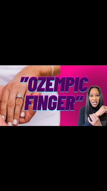What is “Ozempic Finger?” 😮 A Doctor Explains