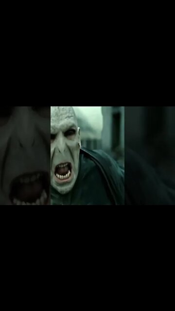 ✨Eye Twitch Party Trick✨😂