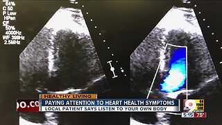 Healthy Living: Women need to pay attention to heart health symptoms