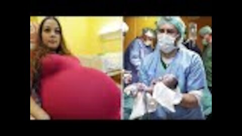 This Woman Had A Rare Delivery That Happens Once In 480 Years!