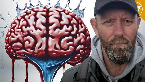 How Likely is Alcoholic Wet Brain For Drinkers? Pay Attention If You Drink Alcohol!