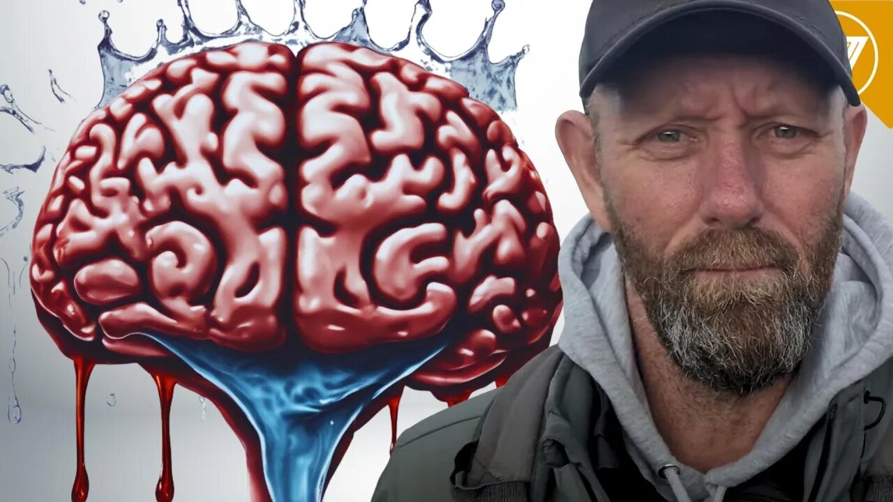 How Likely is Alcoholic Wet Brain For Drinkers? Pay Attention If You Drink Alcohol!