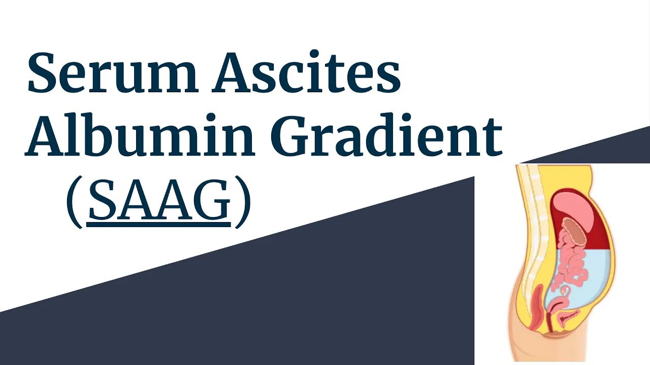 Serum Ascites Albumin Gradient (SAAG) Explained: Causes, Interpretation & Clinical Use |Novice Medic