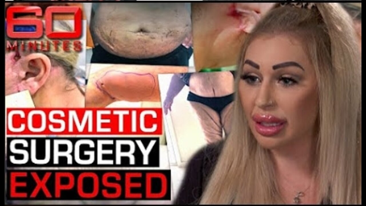 Exposing the dark underbelly of the cosmetic surgery industry _ 60 Minutes Australia