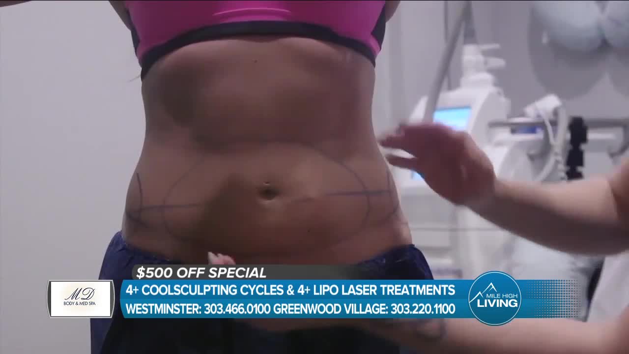 MD Body & Med Spa // Coolsculpting Meets The Laser! // FreezeFatDenver.com