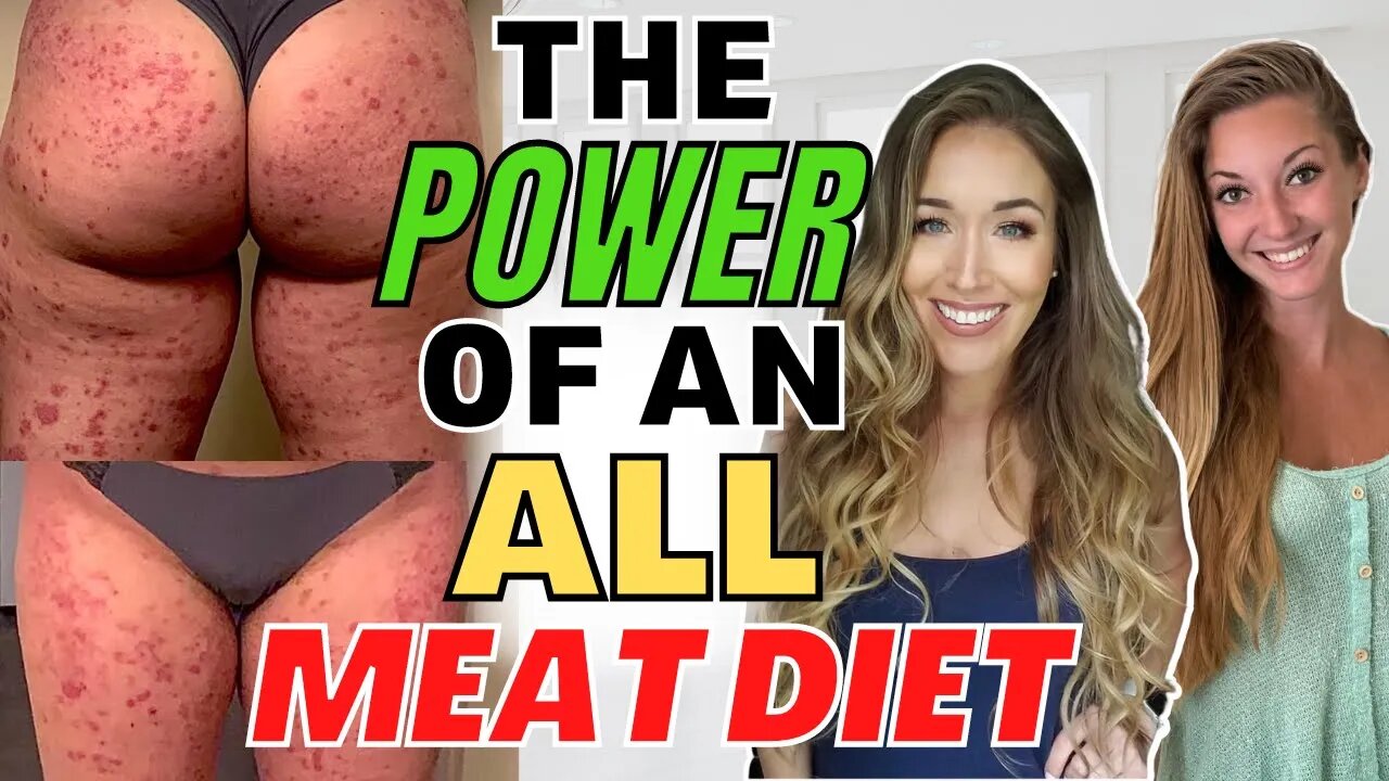 MEAT ONLY Carnivore Diet & 75 Hard Challenge RESULTS! (Psoriasis & Binge Eating ft Dr. Jen Geissert)