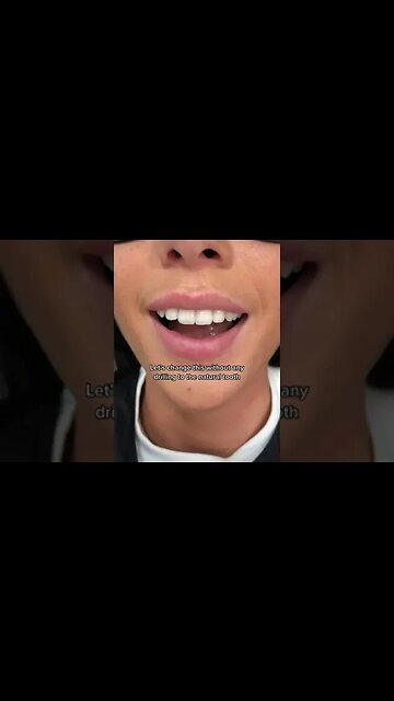 Dental And Teeth Hygiene