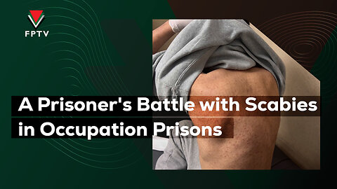 A Prisoner's Battle with Scabies in Occupation Prisons