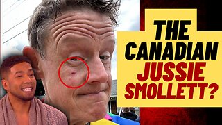 WOKE Canadian Politician Fakes Being Punched At Protest