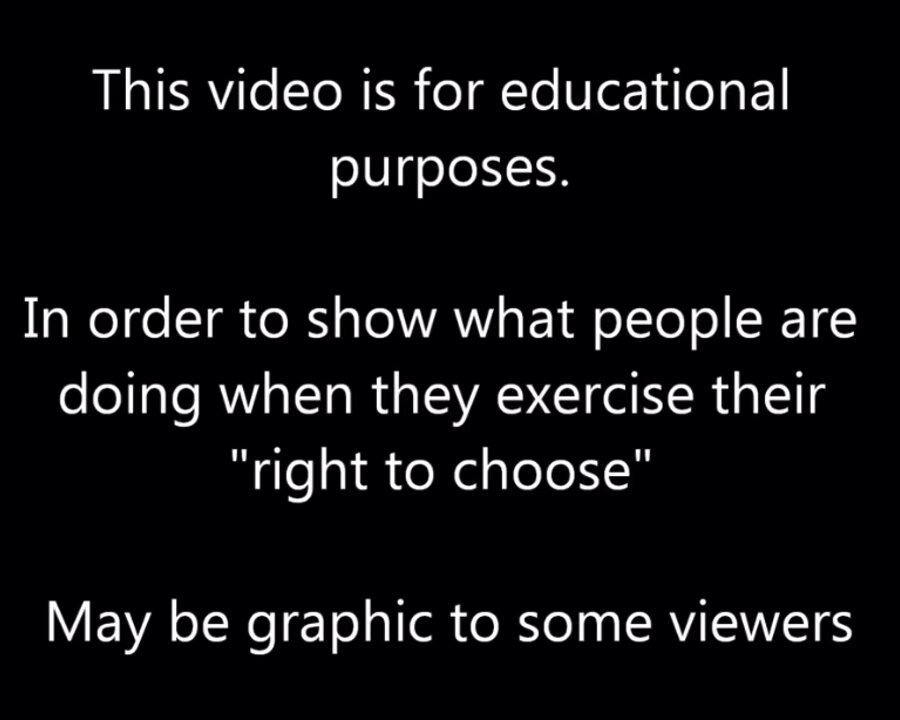 Abortion is Murder 100% PROOF🩸👼🏾🔞
