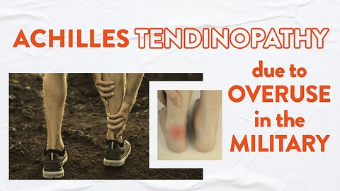 Achilles tendinopathy due to overuse in the military