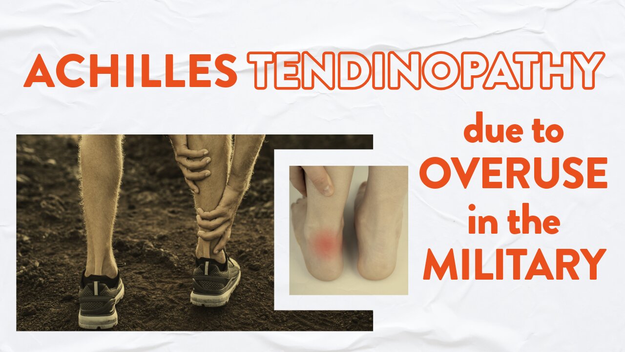 Achilles tendinopathy due to overuse in the military