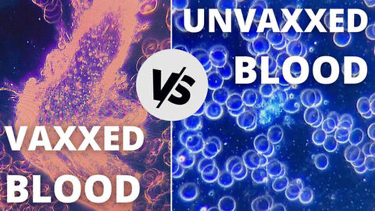 Shocking Under Microscope Expert Found Scary in Unvaxxed Blood