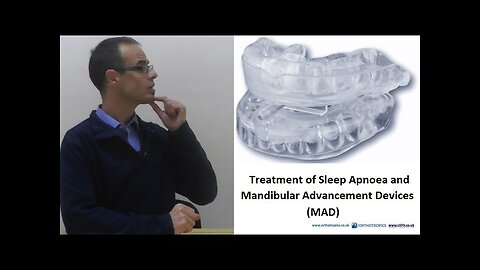 Treatment of Sleep Apnoea by Mandibular Advancement Devices by Dr Mike Mew