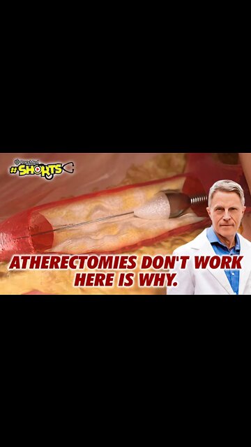 #SHORTS Atherectomies Don't Work. Here is Why
