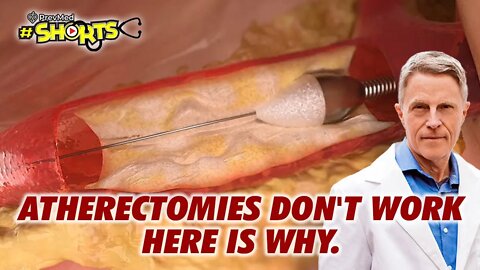 #SHORTS Atherectomies Don't Work. Here is Why