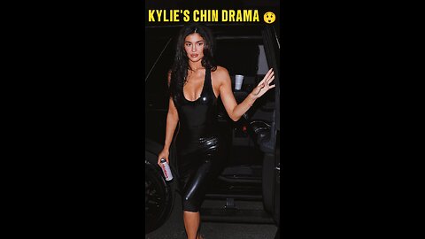 Kylie's Chin Drama 😲 