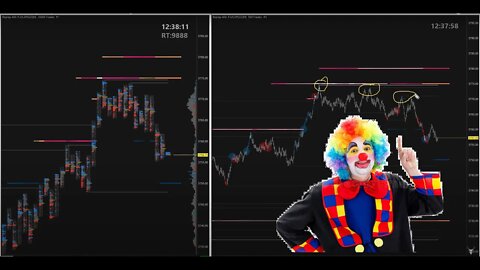 Watch a Dip Trap form within a Trend using advanced Sierra Chart Order Flow Tools